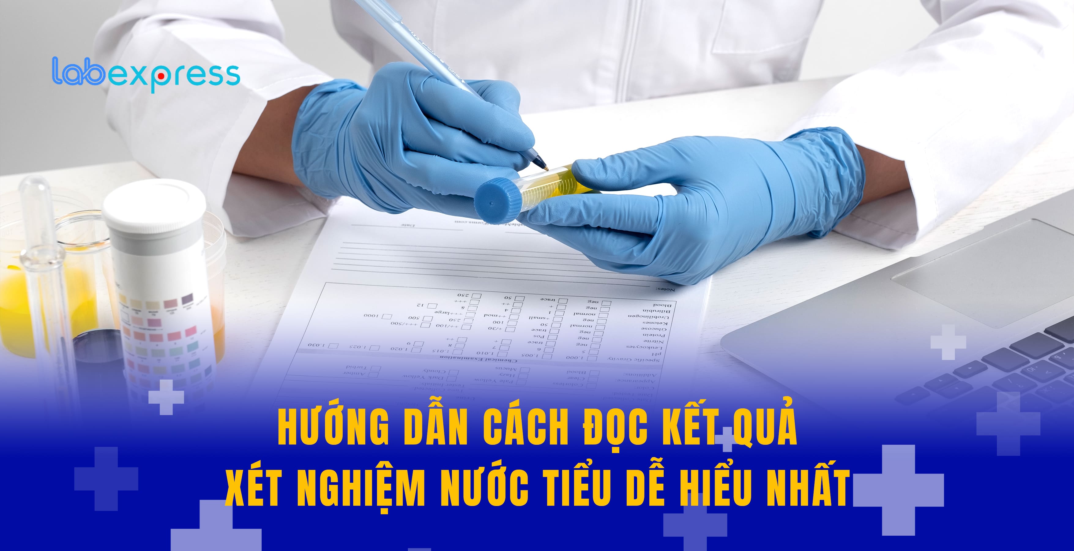 HƯỚNG DẪN CÁCH ĐỌC KẾT QUẢ XÉT NGHIỆM NƯỚC TIỂU DỄ HIỂU NHẤT