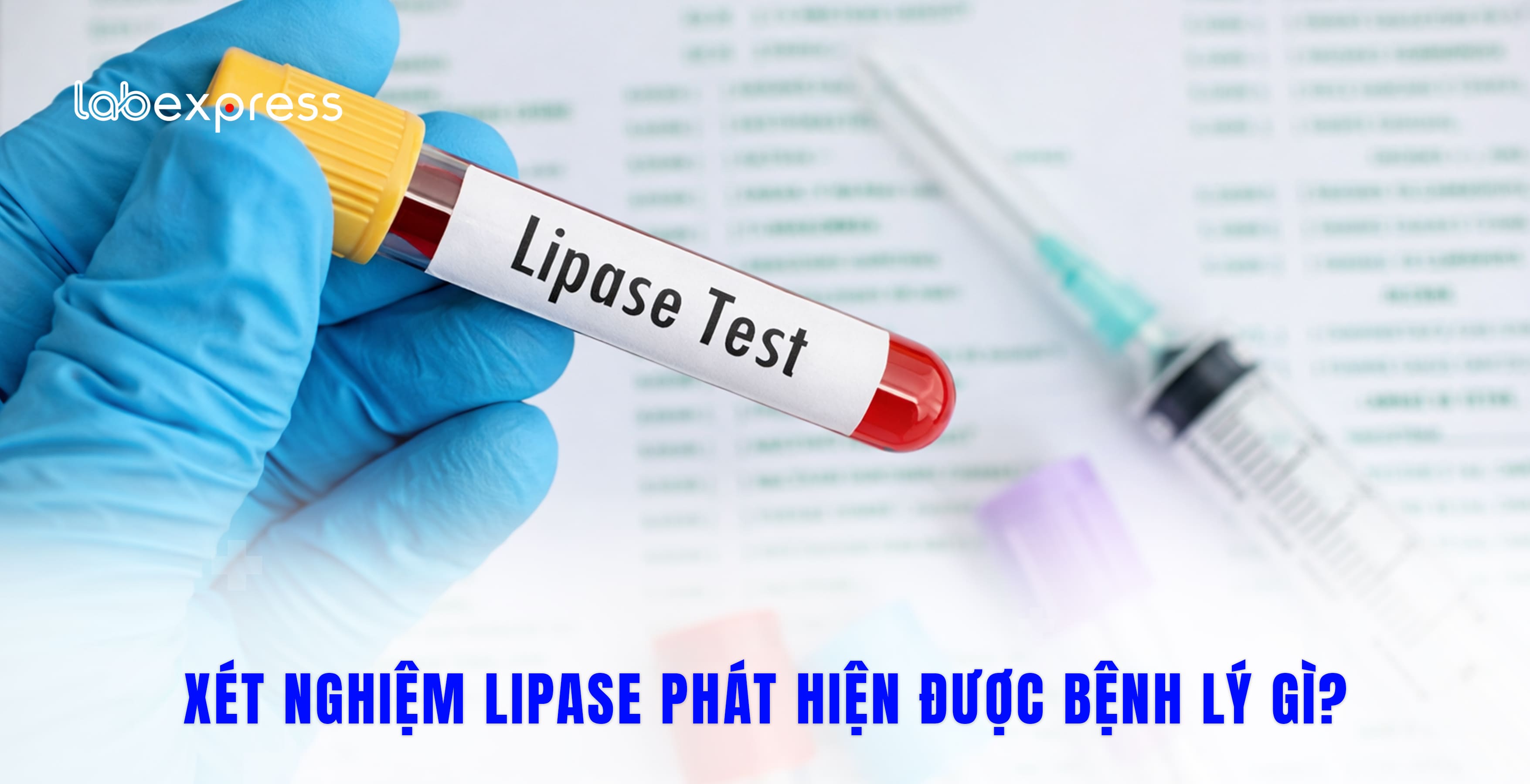 XÉT NGHIỆM LIPASE PHÁT HIỆN ĐƯỢC BỆNH LÝ GÌ?
