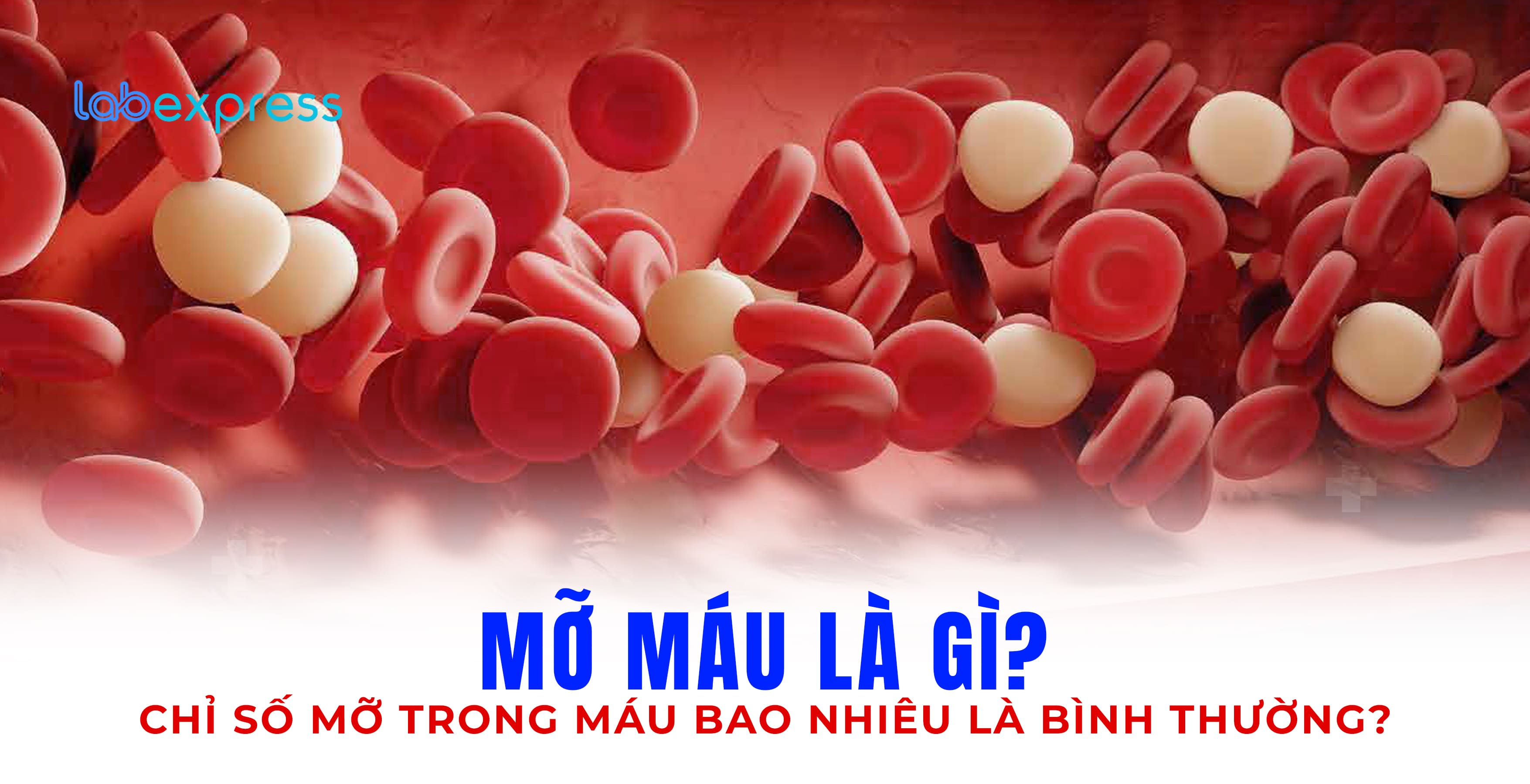 MỠ MÁU LÀ GÌ? CHỈ SỐ MỠ TRONG MÁU BAO NHIÊU LÀ BÌNH THƯỜNG?